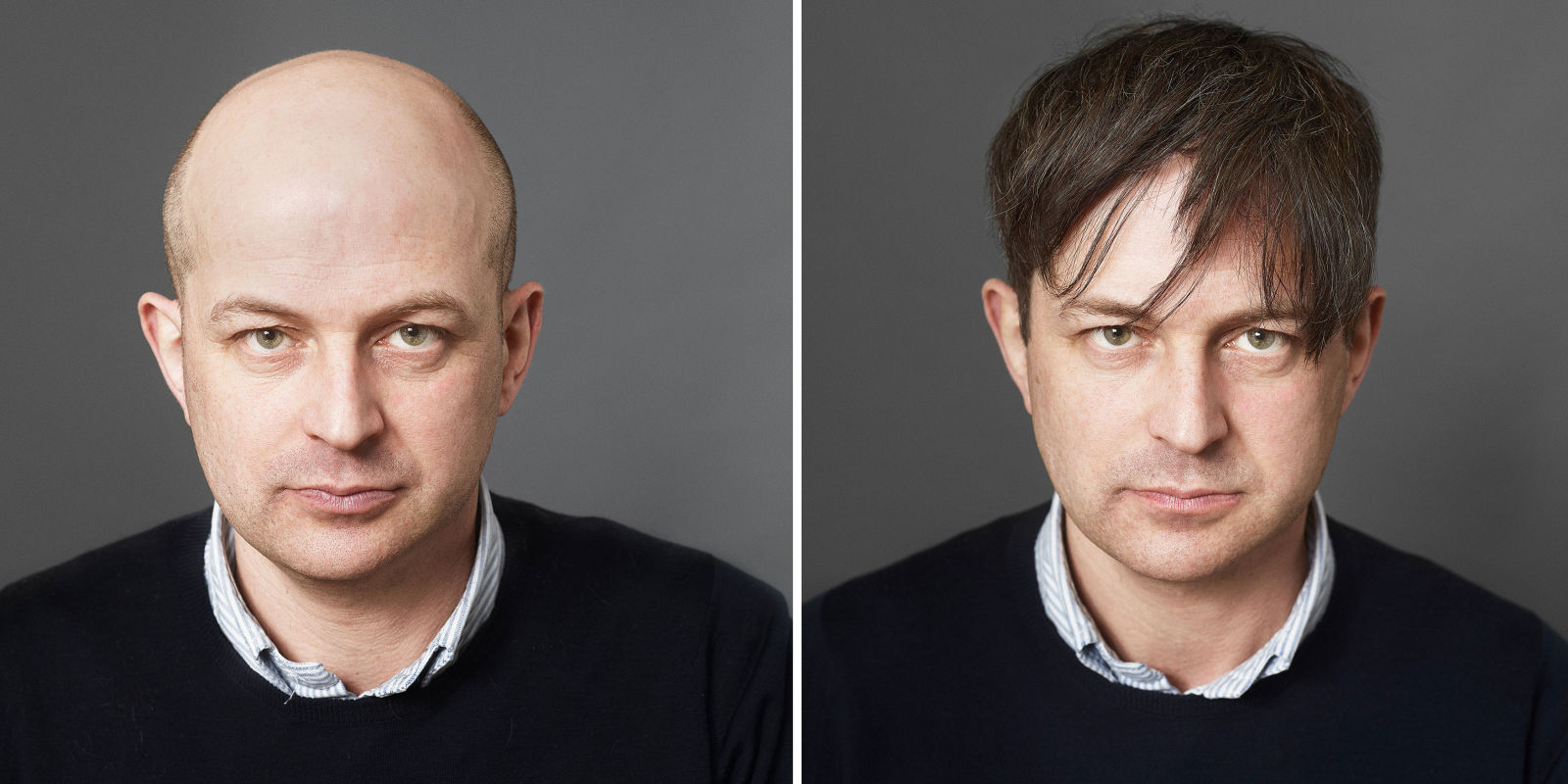 What balding vs shaved head her